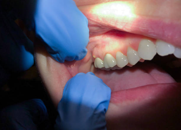 Fast & Reliable Emergency Dental Services in DC