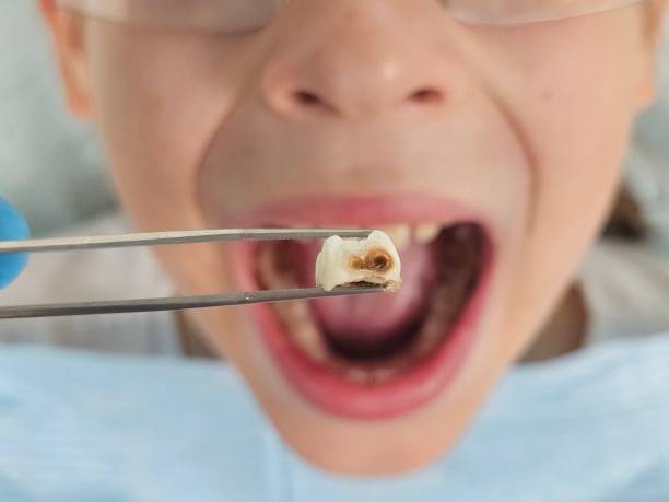 Best Pediatric Emergency Dentist in Washington, DC
